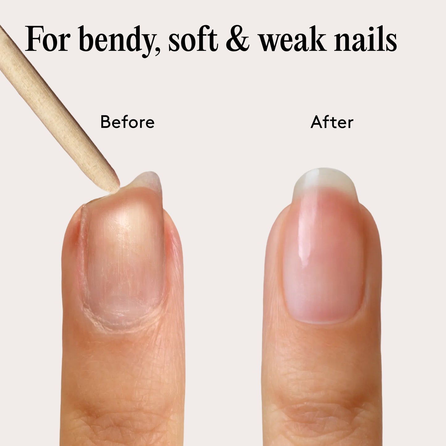 Soin Durcisseur et Réparateur Ongles - Mylee